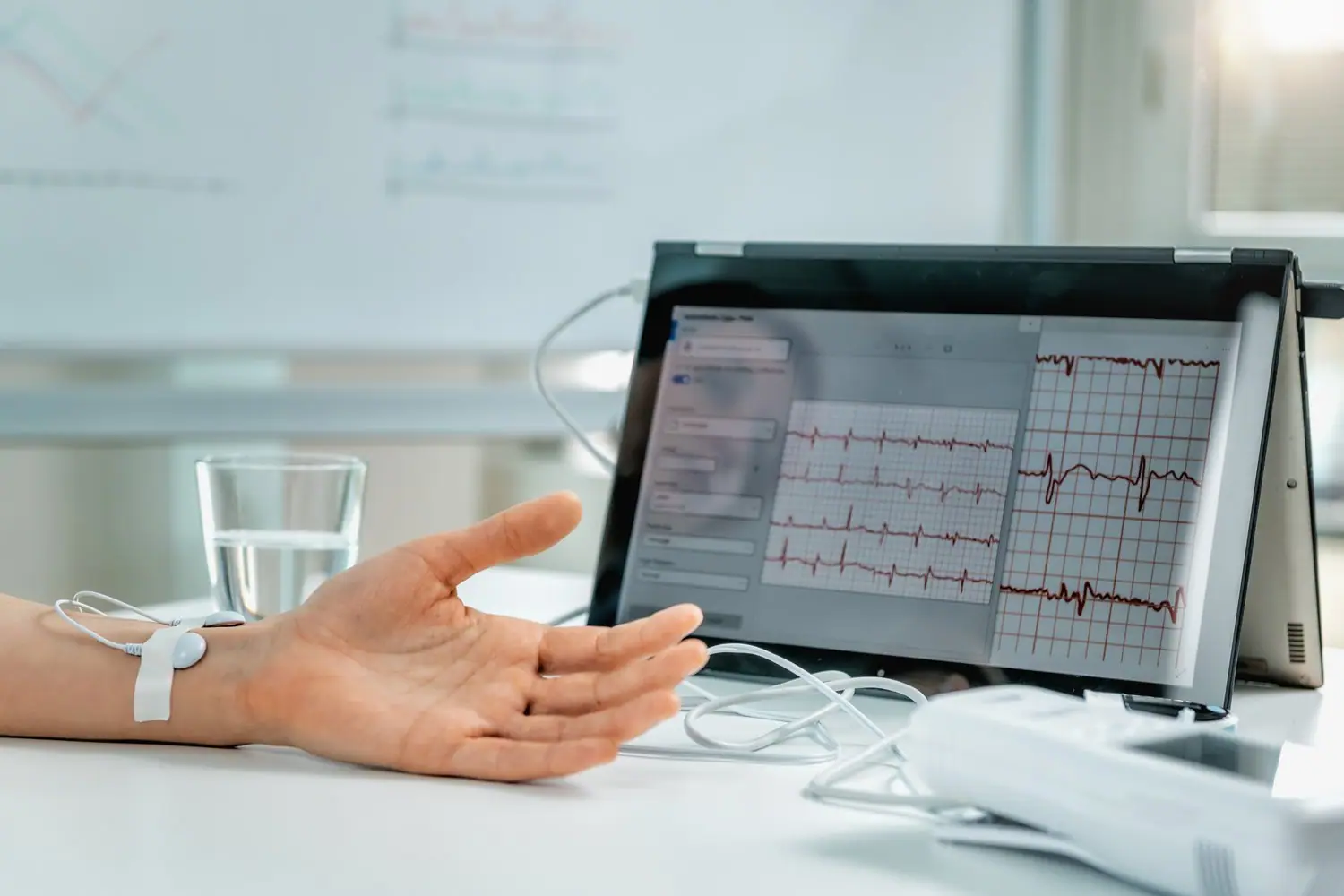 Smart urządzenia do monitorowania zdrowia serca i EKG